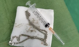 Bé 29 tháng tuổi nuốt sợi dây chuyền vào bụng