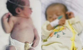 Chữa thành công bé sơ sinh nhiễm bệnh giang mai