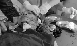 Ông Lộc bị chém nguy kịch cấp cứu tại bệnh viện