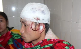 Gấu rừng tấn công người đàn ông “giả chết”