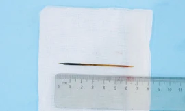 Hi hữu: Người đàn ông ngủ quên, nuốt tăm 7cm vào bụng