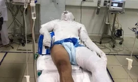 Lộ diện hung thủ tưới xăng đốt nam công nhân ở Vinh