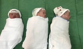 Nghệ An: Sản phụ 23 tuổi sinh 3 hiếm gặp 