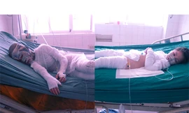 Bị cấm yêu bé 10 tuổi, tạt a-xít cả nhà