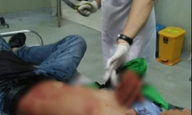 Nhân viên quán nhậu đâm khách vì chê tiền bo ít