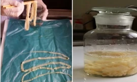 Mẫu sán lợn được Viện Sốt rét- Ký sinh trung và Côn trùng lâý từ lợn nhiễm bệnh ở BÌnh Phước