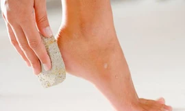 Vì sao tay, chân bị cước khi trời lạnh?