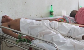 Hôn mê vì đôi đũa đâm xuyên sọ não