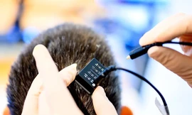 Công nghệ giúp người bị liệt 'nói chuyện'