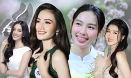Dàn hậu Việt "lột xác" nhờ niềng răng: Tiểu Vy đạt tỷ lệ vàng, Đỗ Thị Hà mặt nhỏ hơn