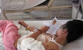 Đang chạy xe, thiếu nữ lãnh nguyên ca axit