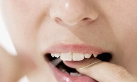Răng có liên quan tới bệnh tim và tiểu đường