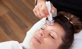 Thẩm mỹ laser thu nhỏ lỗ chân lông