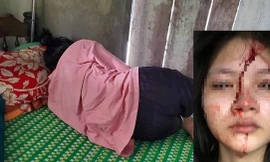 Nhiều vụ học sinh đánh nhau, ngành giáo dục ‘chẩn bệnh’ bạo lực học đường