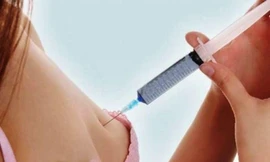 Tự tiêm chất nâng ngực, một phụ nữ tại Huế nhập viện