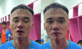 VFF phạt nặng hai cầu thủ đánh nhau ở giải hạng Nhất 