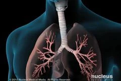 Virus corona gây viêm phổi khiến con người chết vì thiếu oxy như thế nào?