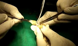 Phẫu thuật cứu rắn bị rách cổ họng do cố gắng ăn tắc kè