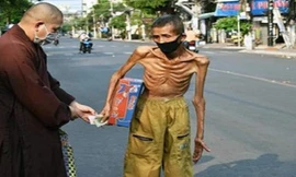 Hình ảnh người đàn ông da bọc xương khiến nhiều người xót thương