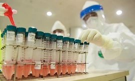 Hai phương pháp xét nghiệm nCoV khác nhau thế nào