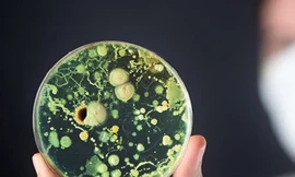 Siêu khuẩn nguy hiểm mới đang lây lan