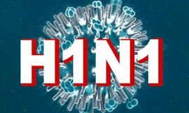 Những triệu chứng bệnh cúm A/H1N1 cần biết