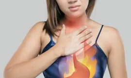 Nguyên nhân gây trào ngược dạ dày