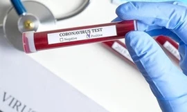 Vì sao bệnh nhân COVID-19 có thể dương tính lại sau 2 lần âm tính?