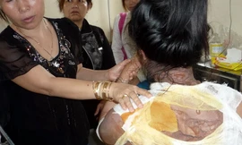 Chưa ngăn chặn người chồng tạt nước sôi vợ