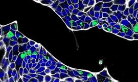 Phát hiện ra vi khuẩn đường ruột khiến nhiễm trùng tái phát ở vùng sinh dục