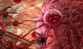 Xác định được con đường vô hiệu hóa tế bào ung thư?