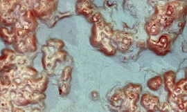 Bất ngờ phát hiện thành phố Maya cổ nhờ bắn tia laser