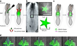 Sử dụng cảm biến in 3D để đo dị tật tủy sống ở phôi thai 