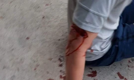 Nha Trang chỉ đạo xử lý vụ chó cắn du khách nước ngoài nhập viện