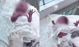 Bé gái sơ sinh bị bỏ rơi bên bờ sông Tắc