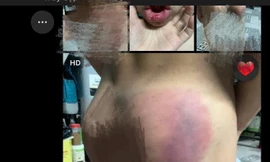 Cô giáo dạy thêm bị tố đánh học sinh chảy máu miệng, sưng đầu