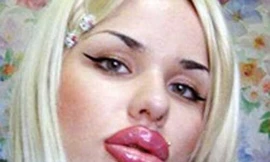 Bơm môi để giống nhân vật hoạt hình