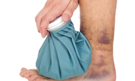 Mẹo hay trị vết thâm tím