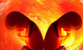 Thai nhi trong dạ dày cậu bé 4 tuổi