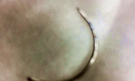 Bác sĩ bỏ quên kim khâu trong vùng kín sản phụ ở Bình Phước