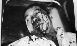  Ông Dũng bị nhóm côn đồ đánh nhập viện