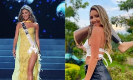 Nghị lực phi thường của Hoa hậu Hoàn vũ Colombia từng phải cắt bỏ chân trái