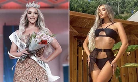 Mỹ nhân sở hữu thân hình vệ nữ đăng quang Hoa hậu Trái đất Albania