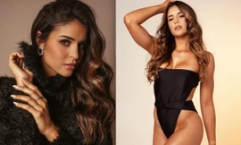 Mỹ nhân từng bị ung thư tuyến giáp đăng quang Hoa hậu Brazil 2021 