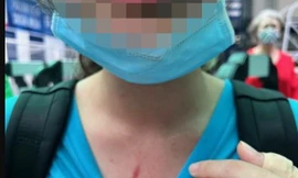 UBND TPHCM chỉ đạo 'nóng' vụ học sinh bị đánh ở trường quốc tế