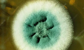 Nấm Aspergillus fumigatus được quan sát bằng kính hiển vi. Ảnh: sciencephoto.com