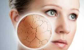 Tránh xa những thực phẩm này vào mùa hè kẻo cơ thể 'héo khô' vì mất nước