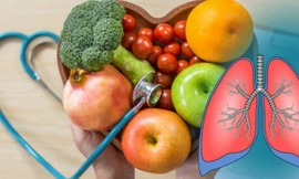 Những thực phẩm là ‘máy hút bụi’ cho phổi, càng ăn càng lọc sạch phổi mỗi ngày