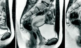 Làm 'chuyện ấy' trong máy chụp cộng hưởng từ và những bức ảnh chấn động 