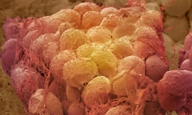 Phát hiện ra mối liên hệ giữa mỡ và não, có thể ngăn ngừa bệnh béo phì trong tương lai